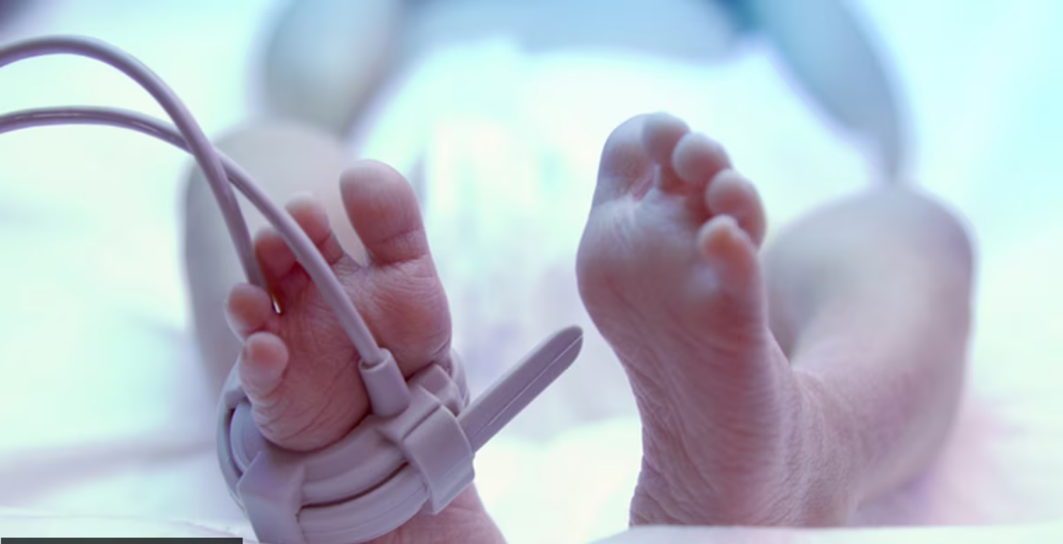 Find out all about pediatric intensive care, and how it is different from neonatal intensive care